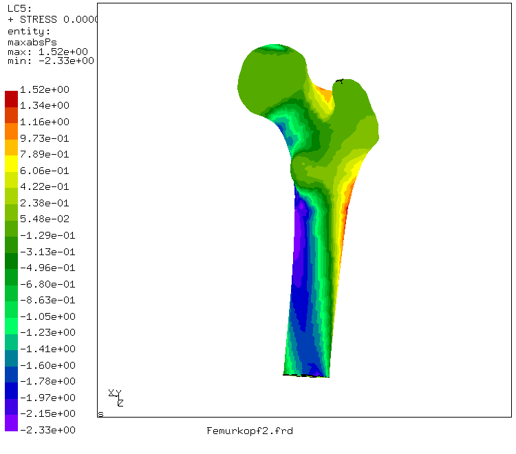 Highest principal stress - back view